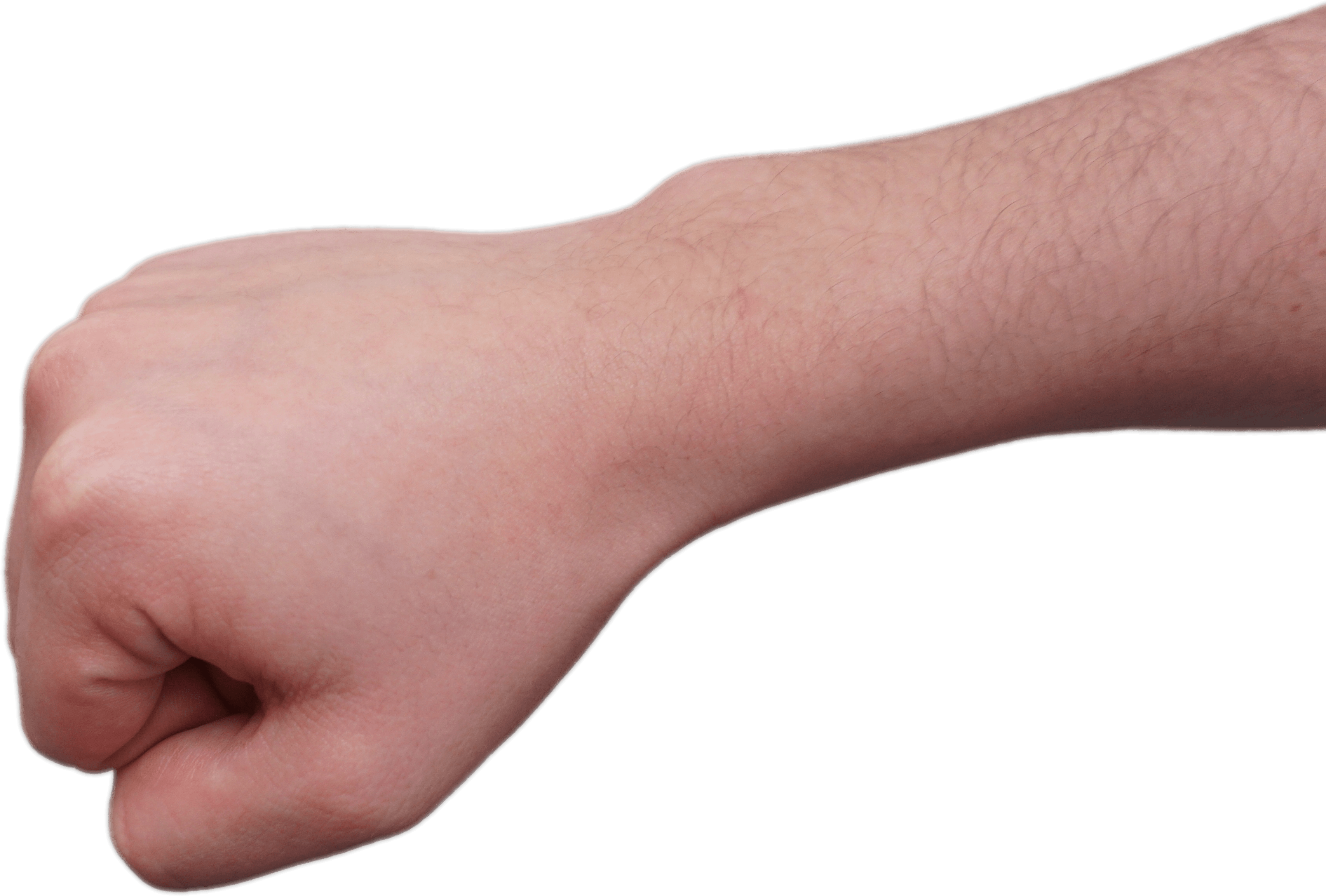 Clenched Fist And Forearm - Disease Clipart (4492x2720), Png Download