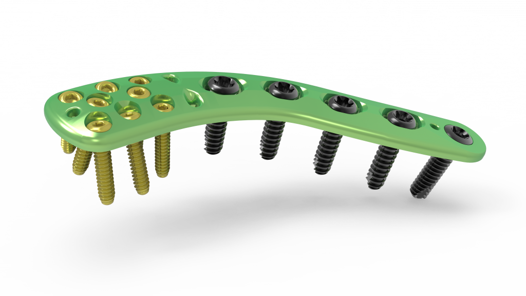 See All Images - Distal Clavicle Plate Clipart (1024x576), Png Download