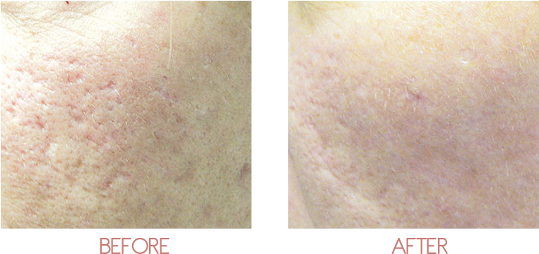 About - Scar Clipart (800x400), Png Download
