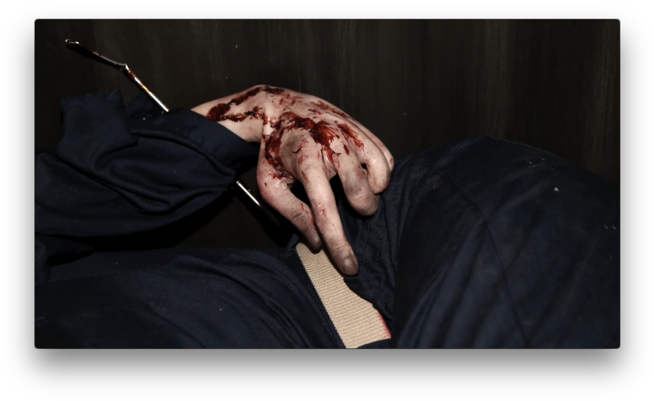 #ncis Evidence Files - Injury Clipart (935x575), Png Download