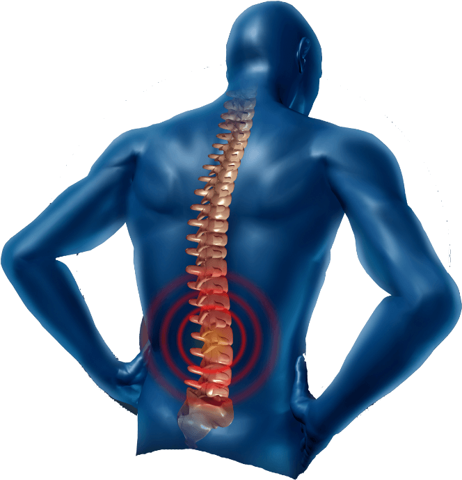 Pain In The Neck Png Transparent Image - Lower Back Pain Png Clipart (775x775), Png Download