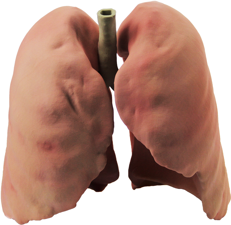 Real Lungs Png , Png Download Clipart (794x775), Png Download