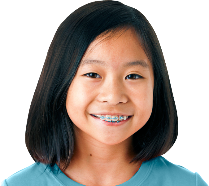 Girl-braces - Girl Braces Transparent Png Clipart (675x600), Png Download