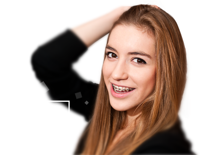 Braces Allow You To Fix Crowding, Irregularly Spaced - Braces Smile Png Clipart (689x533), Png Download