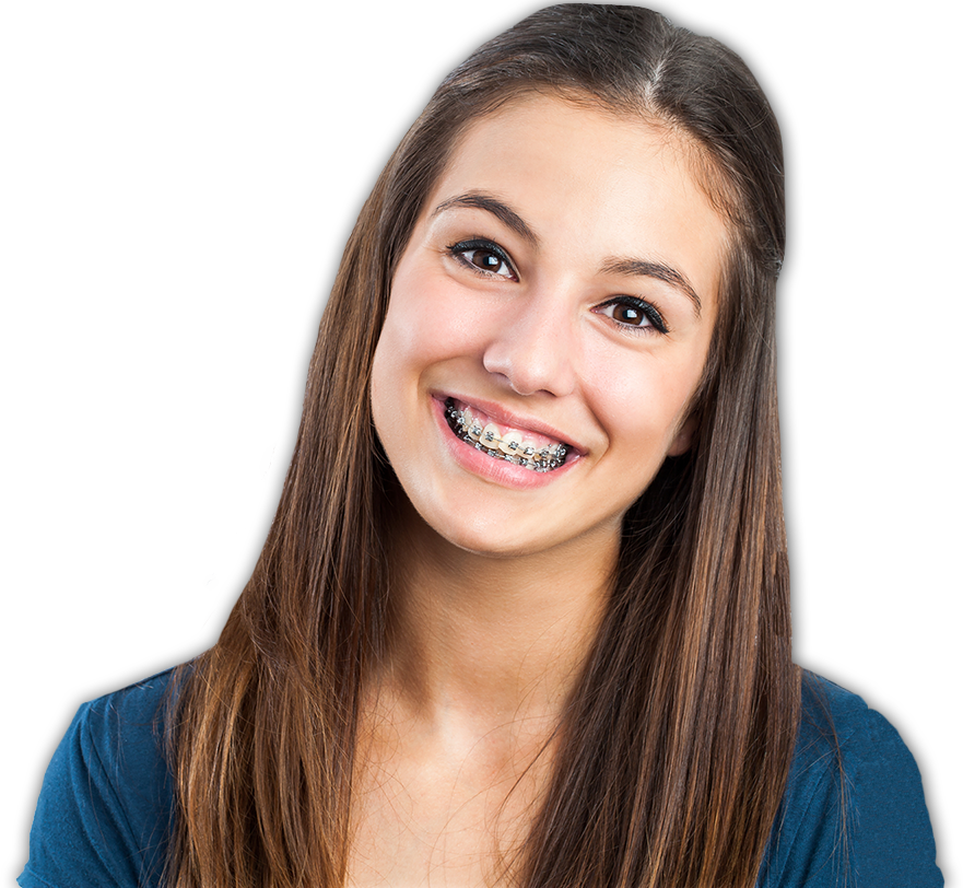 Sonrisa Con Brackets Png - Pessoas Sorrindo Com Aparelho Clipart (881x812), Png Download