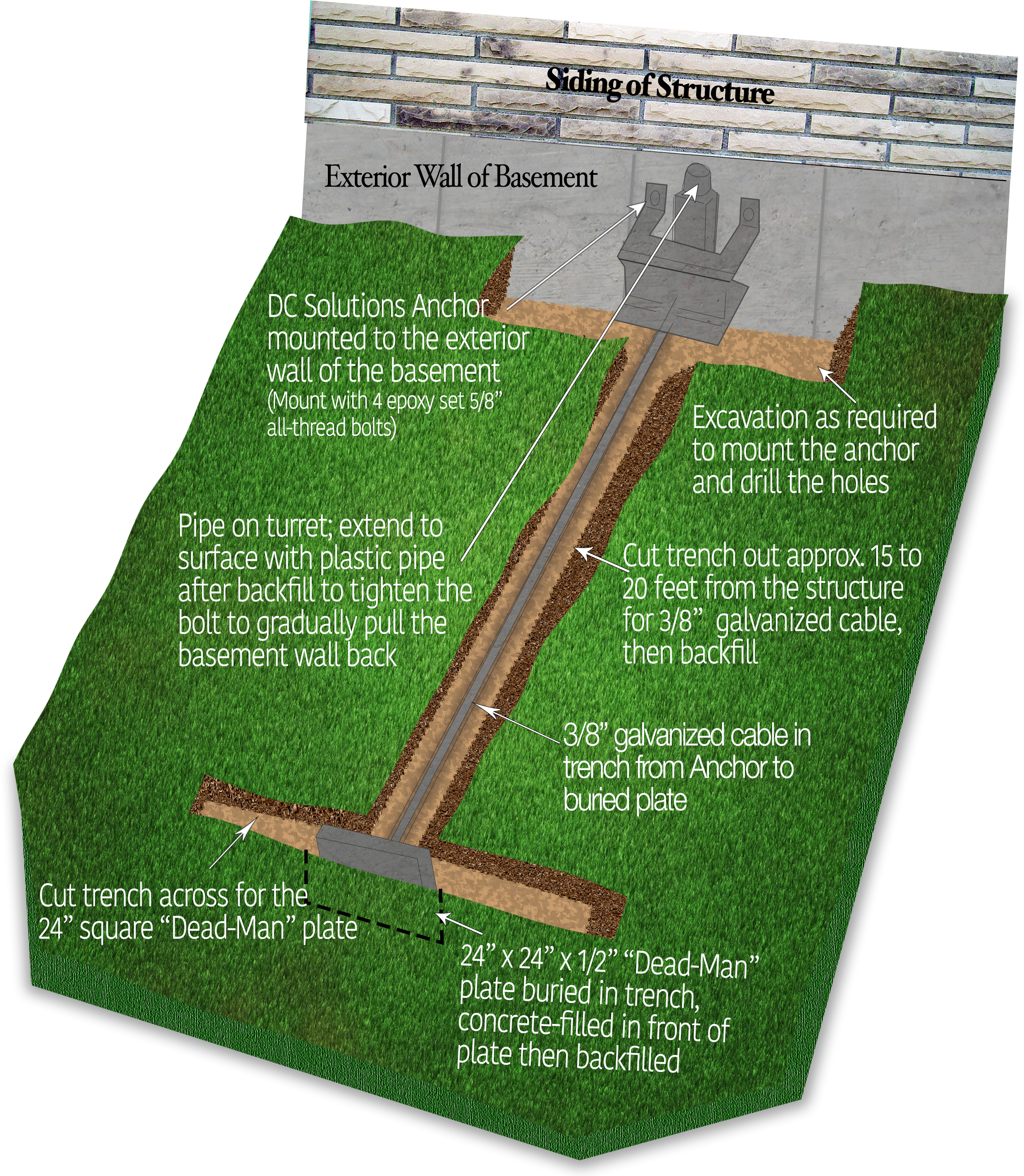 Bowing Walls - Dead Man Anchor Wall Clipart (2532x2915), Png Download