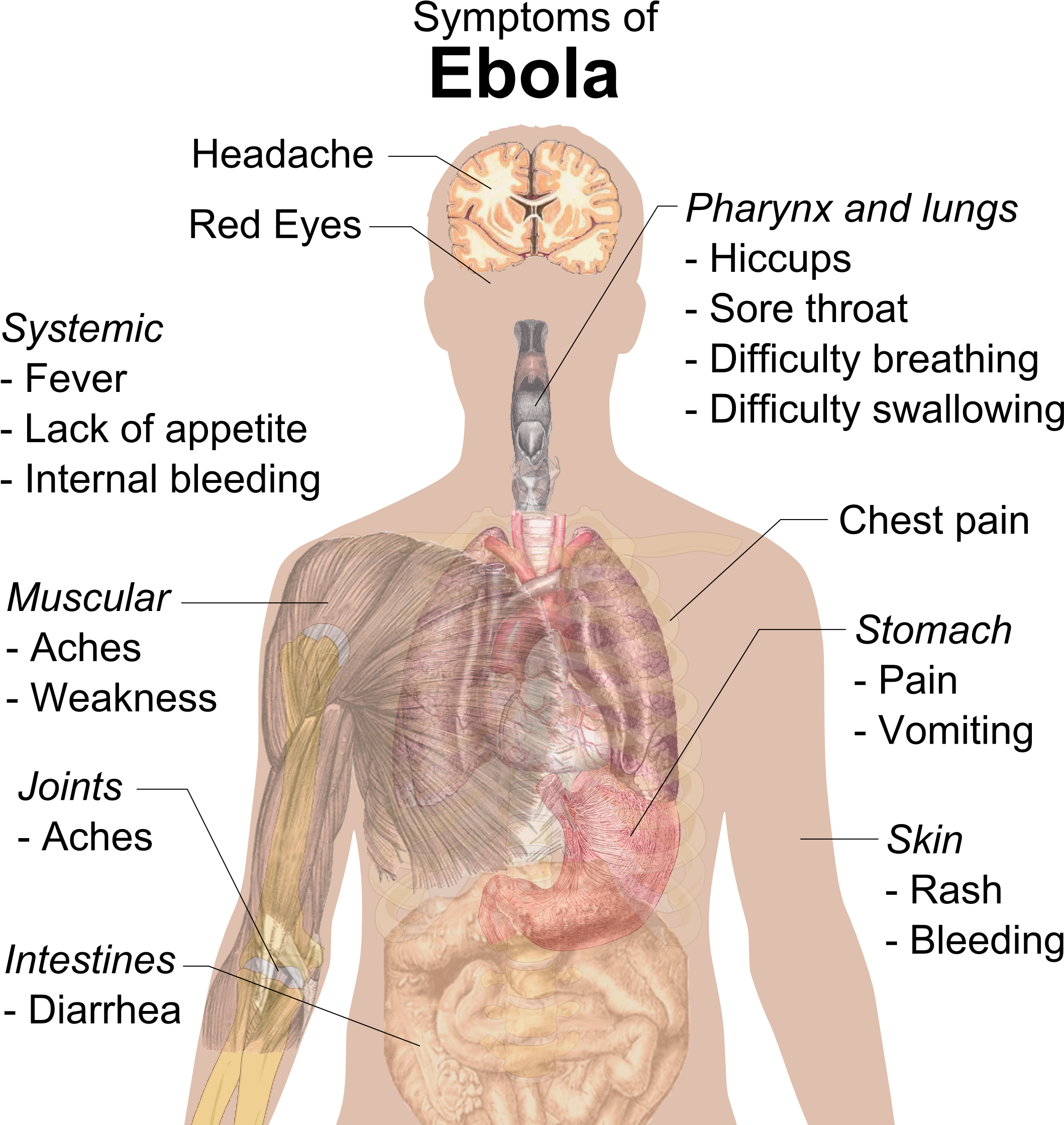 Symptoms Of Ebola Clipart (2234x2256), Png Download