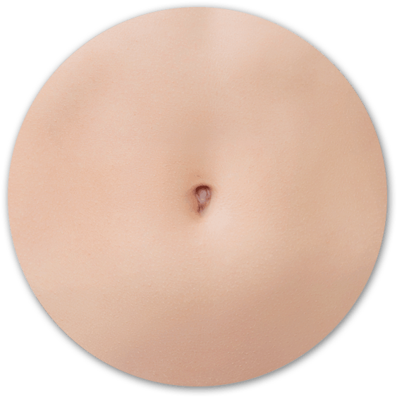 Belly Button Surgery Surrey Clipart (575x575), Png Download