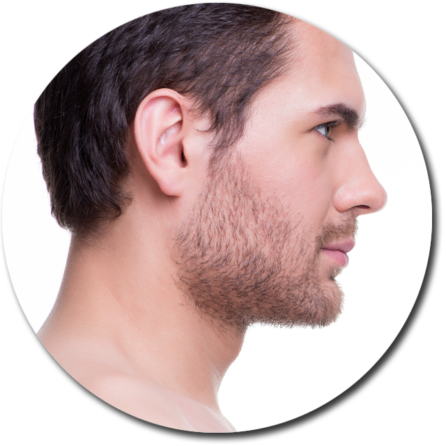 Double Chin Liposuction - Nariz Perfecta Para Hombre Clipart (640x640), Png Download