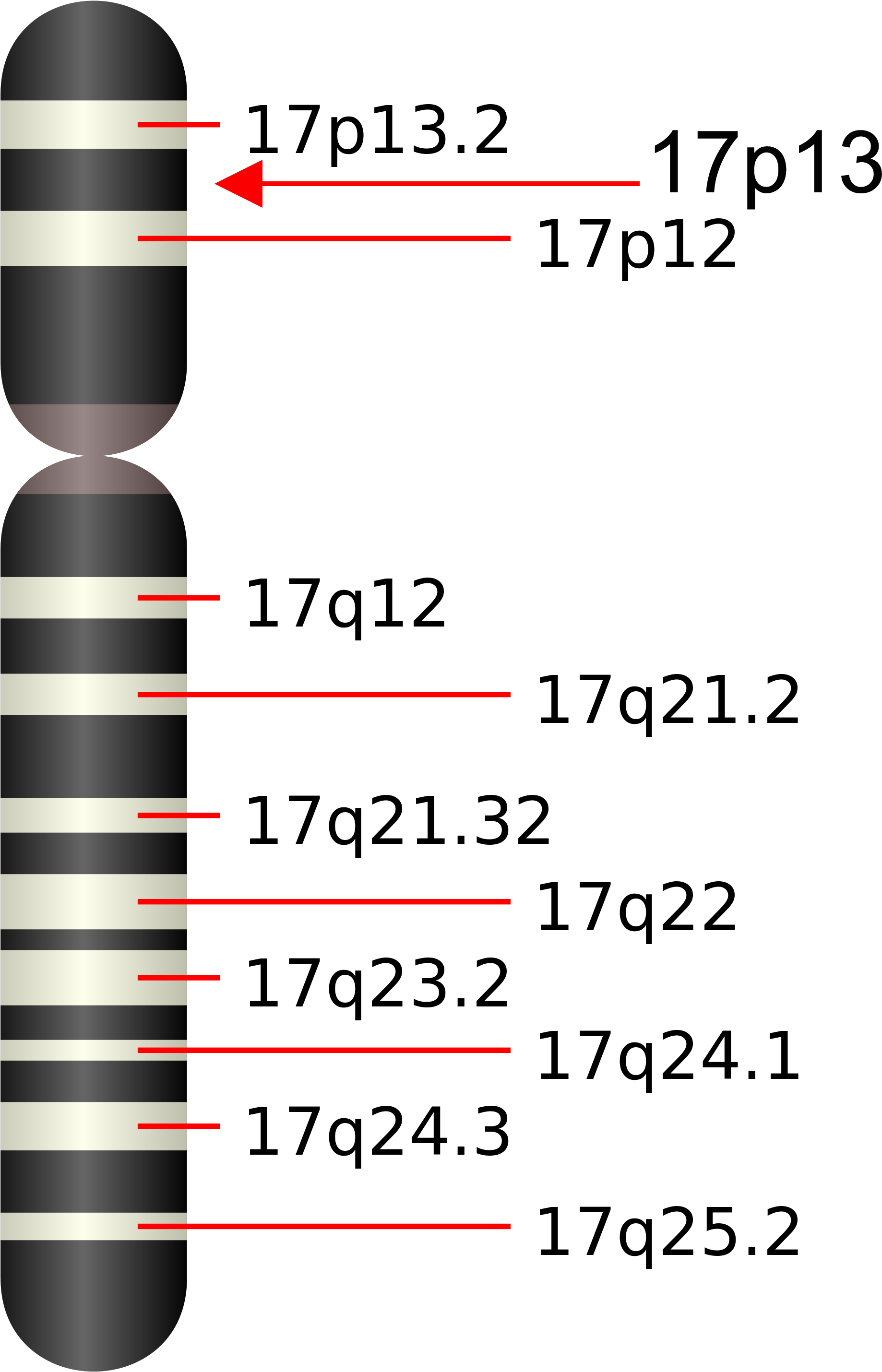 Ucsd Cystine Determination Laboratory - Smith Magenis Syndrome Gen Clipart (2000x3040), Png Download