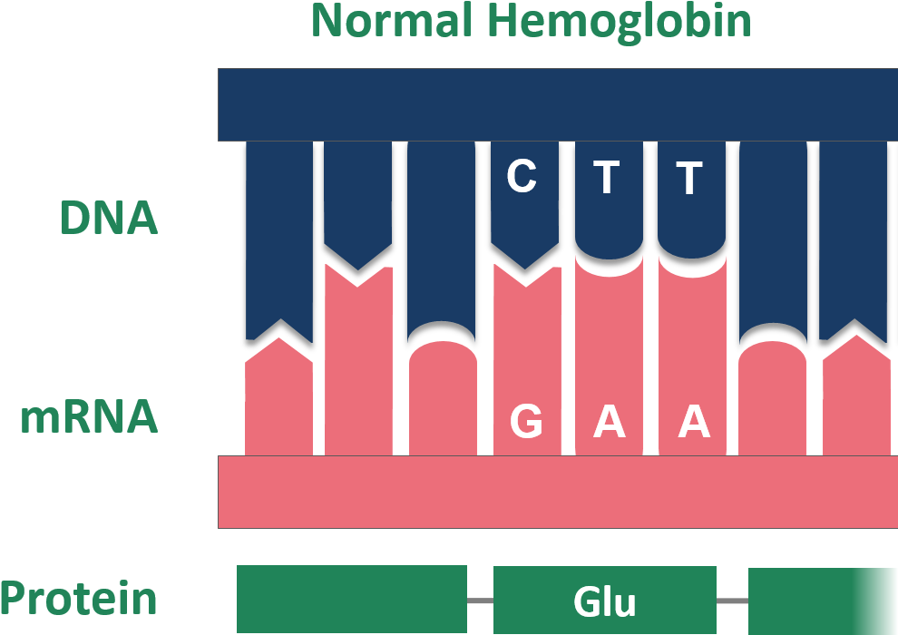 Point Mutation Sickle Cell Normal Hemoglobin , Png - Diagram Sickle Cell Mutations Clipart (990x700), Png Download