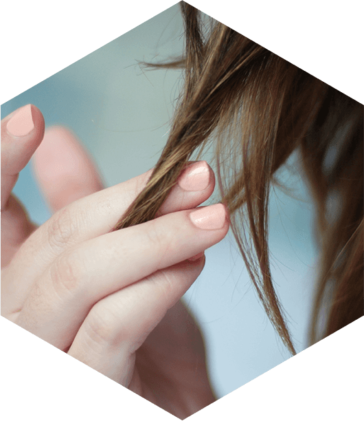 Woman With Hair Loss Touching Hair - Girl Clipart (530x612), Png Download