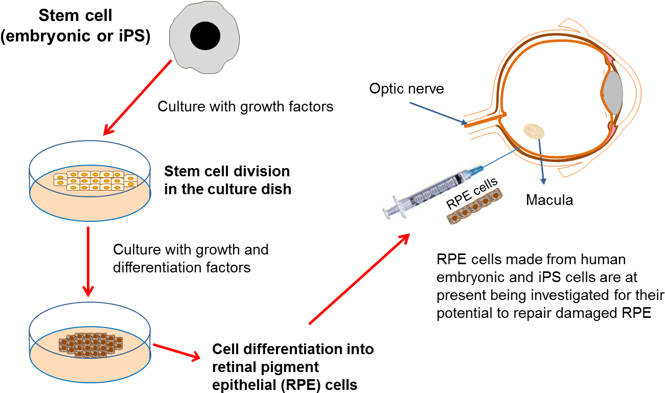 Diagram On Developing Eye Therapies - Stem Cells In Eye Clipart (1347x790), Png Download