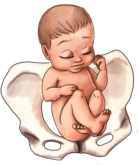 Breech Baby Position - Baby Hand Position In Womb Clipart (500x647), Png Download