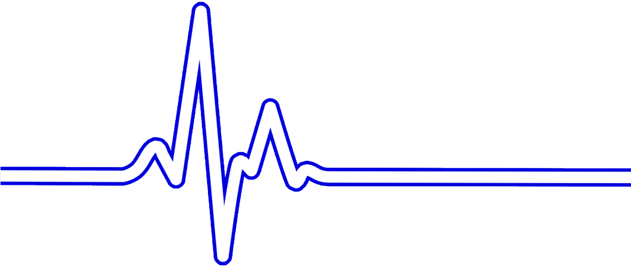 Ekg Clipart Wave - Ekg Transparent - Png Download (960x720), Png Download