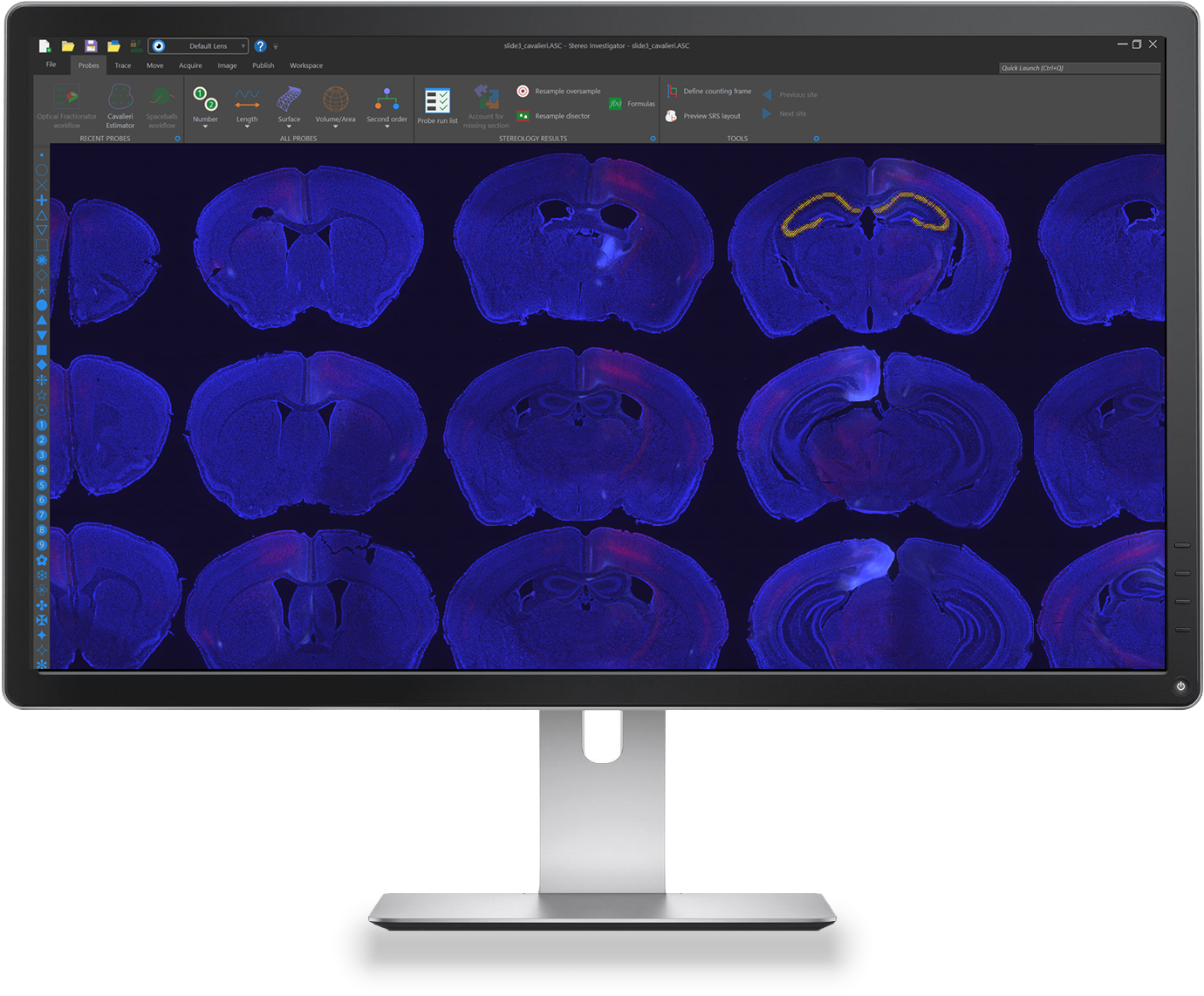 Stereo Investigator Whole Slide Edition Is A Tool For - Computer Monitor Clipart (1500x1162), Png Download