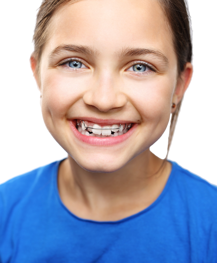 Health - Orthodontic Children Clipart (700x847), Png Download