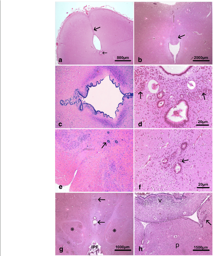 Main Histological Lesions Consisted In Hypoplasia Of - Illustration Clipart (850x821), Png Download