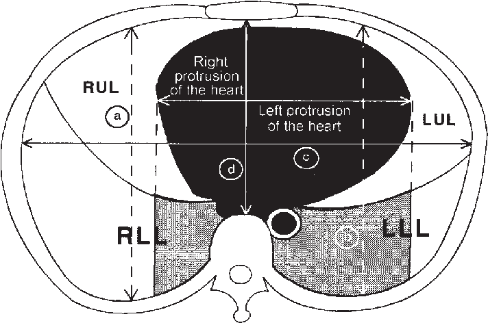 Schematic Representation Of A Ct Section Obtained In - Circle Clipart (747x493), Png Download