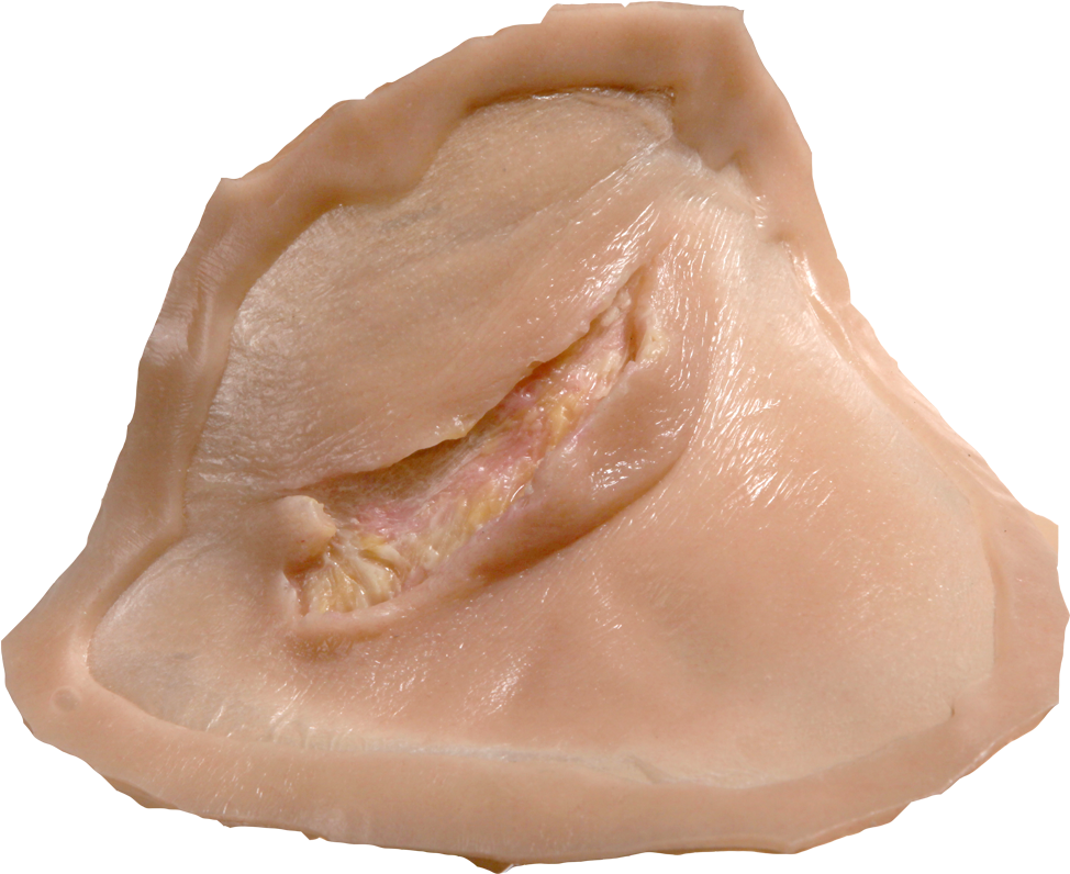 Drawing Scars Bruise - Chicken Breast Clipart (1000x1000), Png Download