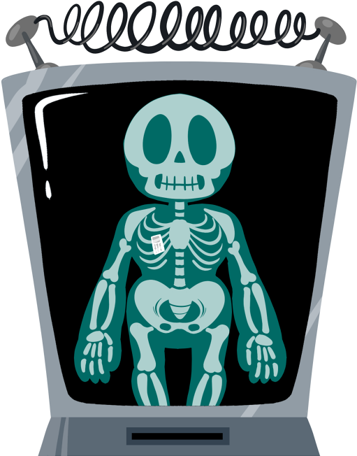 X Ray Png - Xray Png Clipart (555x668), Png Download