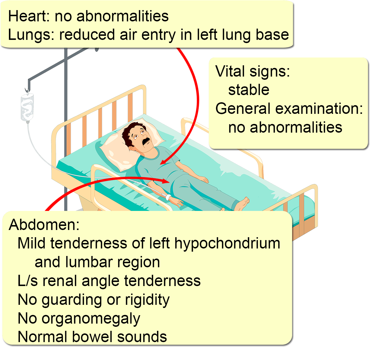 Blood Sugar , Png Download - Neuroleptic Malignant Syndrome Clipart (1283x1201), Png Download