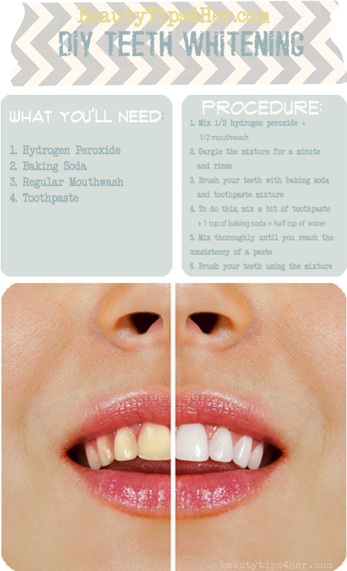 Coco Shine Teeth Png - Teeth Whitening Diy Fast Clipart (490x850), Png Download
