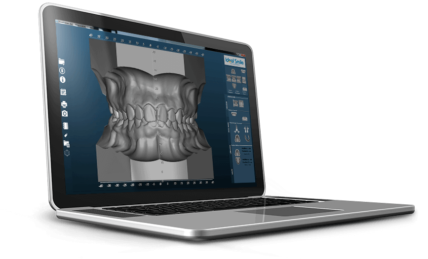 Netbook Clipart (880x634), Png Download