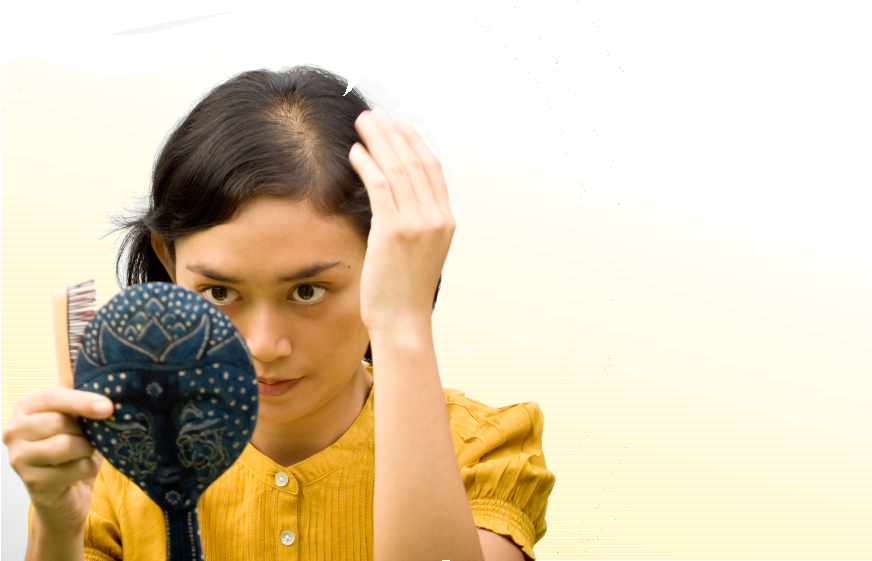 Women Make Up 40% Of Americans With Hair Loss - Beta Blocker Hair Loss Clipart (900x755), Png Download