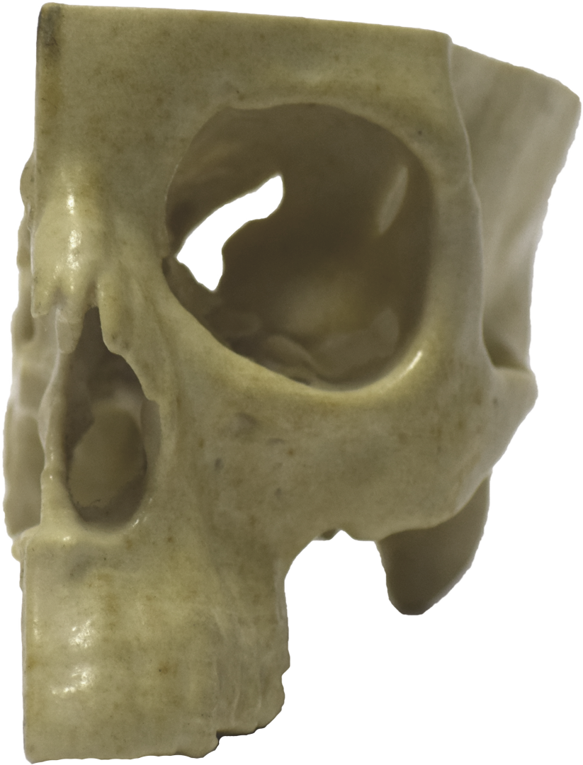Front Of 3d Printed Half Skull - Skull Clipart (823x1080), Png Download