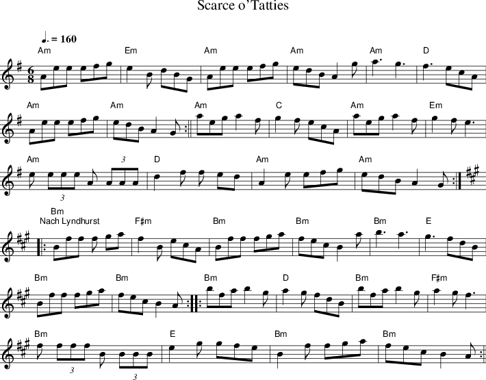 Listen To Scarce O'tatties - Dancers To A Discordant System Drum Clipart (710x555), Png Download