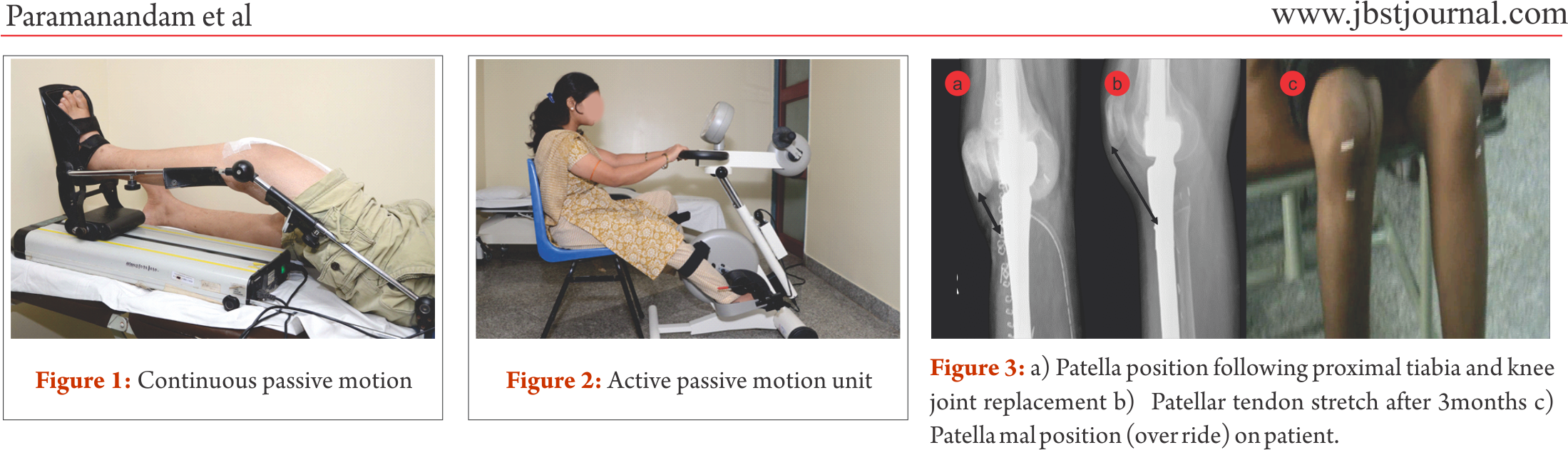 Largely Depends On The Bone And Joint Structure Loss - Computed Tomography Clipart (2198x643), Png Download