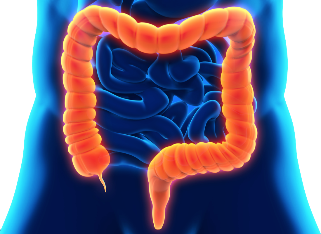 Inflammatory Bowel Disease Dr - Tocoma Colon Cleanser Review Clipart (1099x801), Png Download
