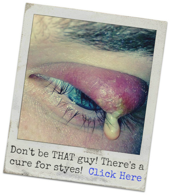 Woke Eyes Png - Stye Symptoms Clipart (565x649), Png Download