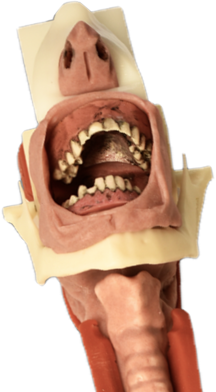 Burn - Tongue Clipart (1500x1500), Png Download