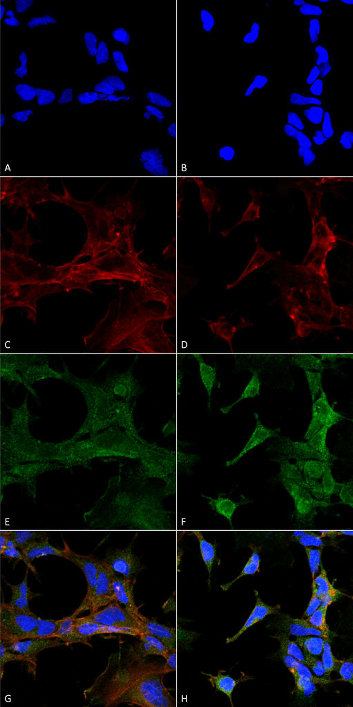 Smc 510 4 Hydroxy 2 Hexenal Antibody 6f10 Icc If Human - Laser Clipart (511x1024), Png Download