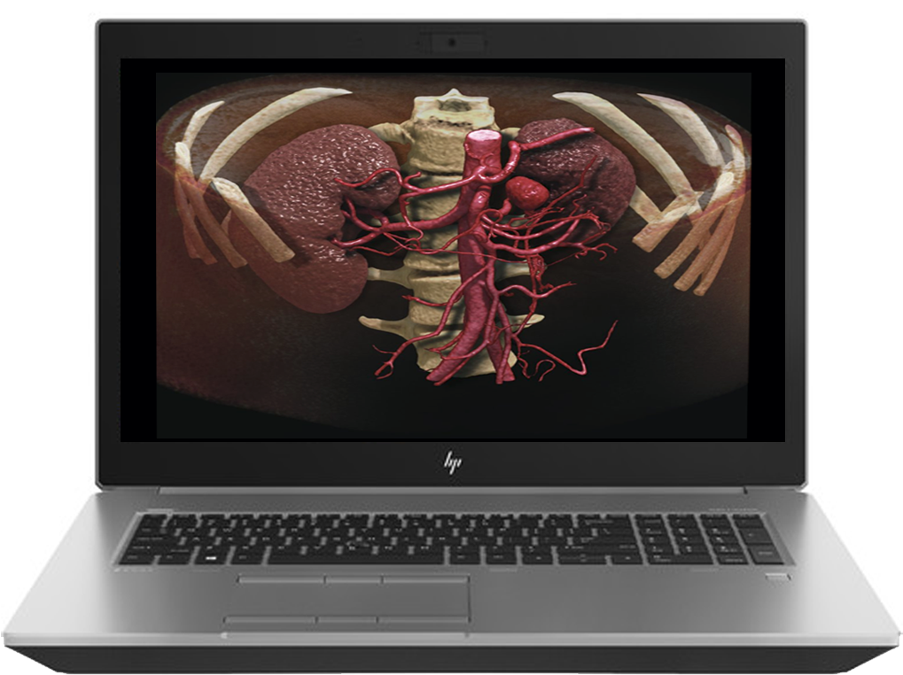 Mobile Workstation - Hp G5 17 Clipart (1119x871), Png Download