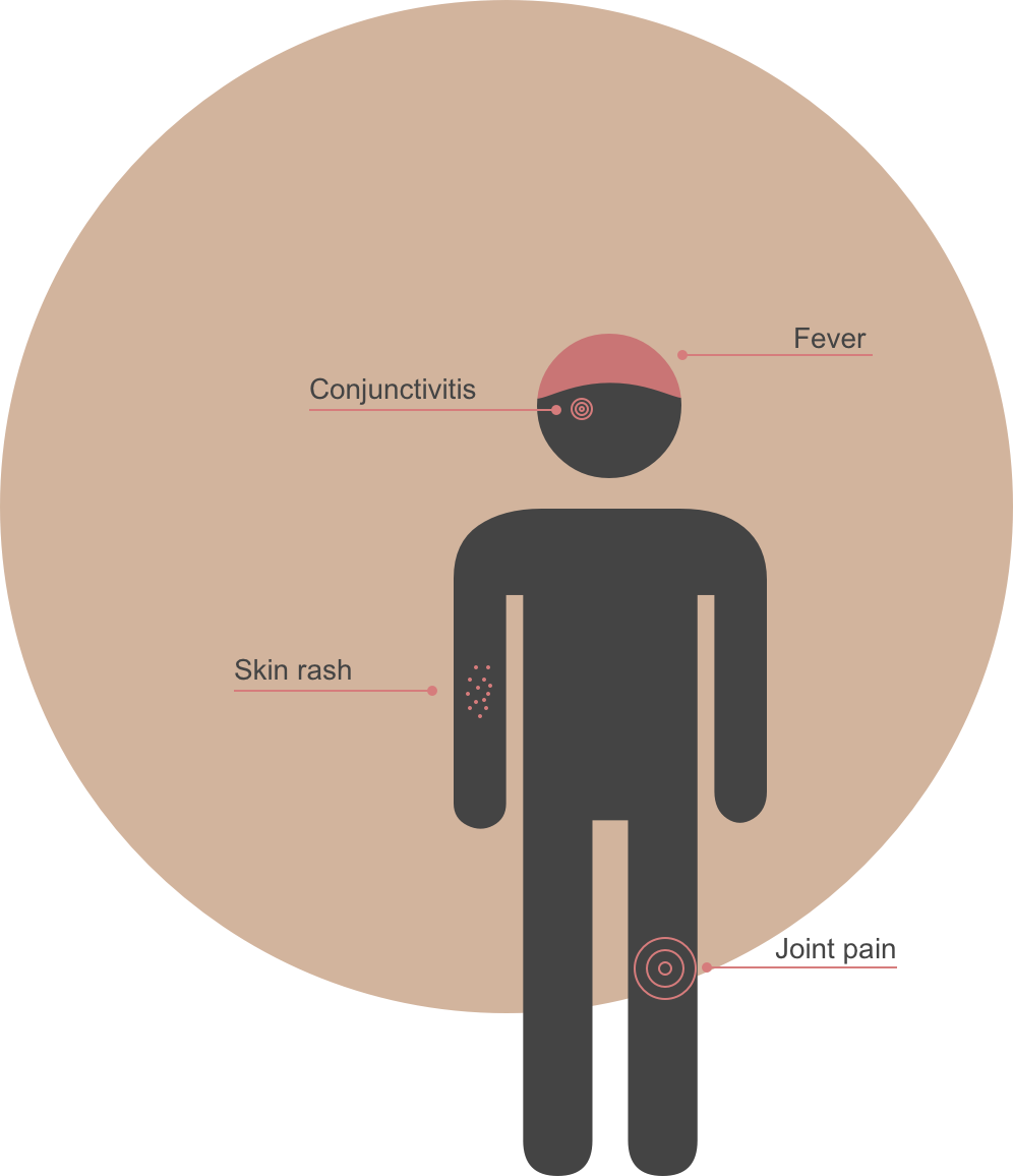 The World Health Organization Has Labeled The Zika - Wc Logo Man Vrouw Png Clipart (996x1156), Png Download