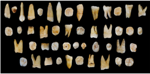 Can 100,000 Year Old Teeth Change Human History - Life Of Earliest People Clipart (300x200), Png Download