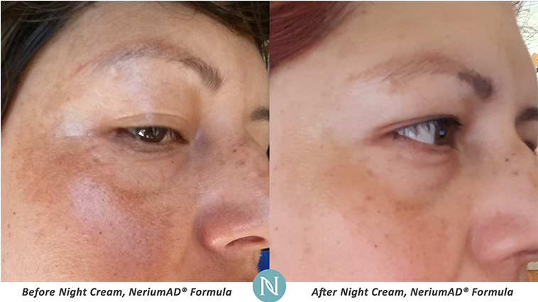 Picture - Close-up Clipart (928x425), Png Download