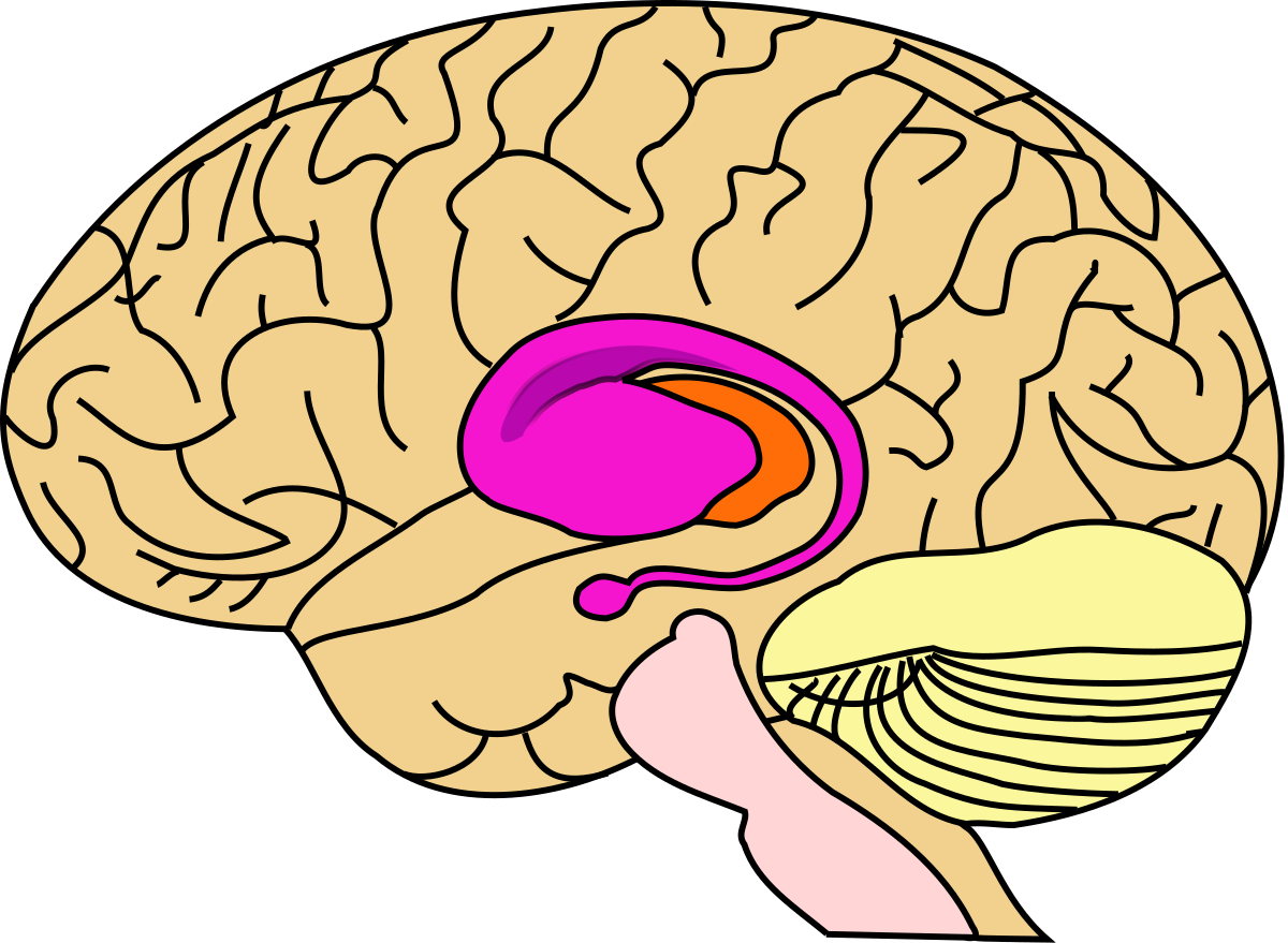 Striatum - Huntington's Disease Clipart (1200x879), Png Download