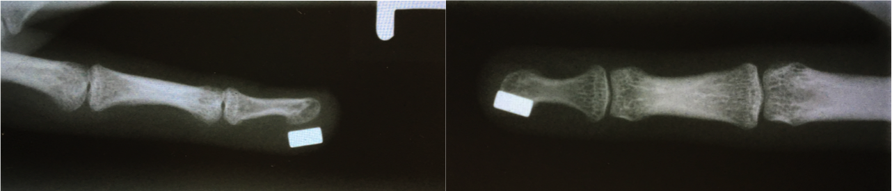 Magnetic Sensory Augmentation - Medical Radiography Clipart (1282x275), Png Download