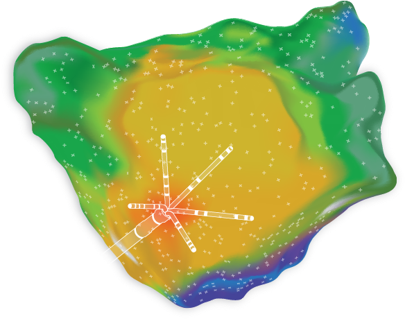 The Confidense® Mapping Module Offers Carto® 3 System - Confidence Module Biosense Webster Clipart (613x612), Png Download