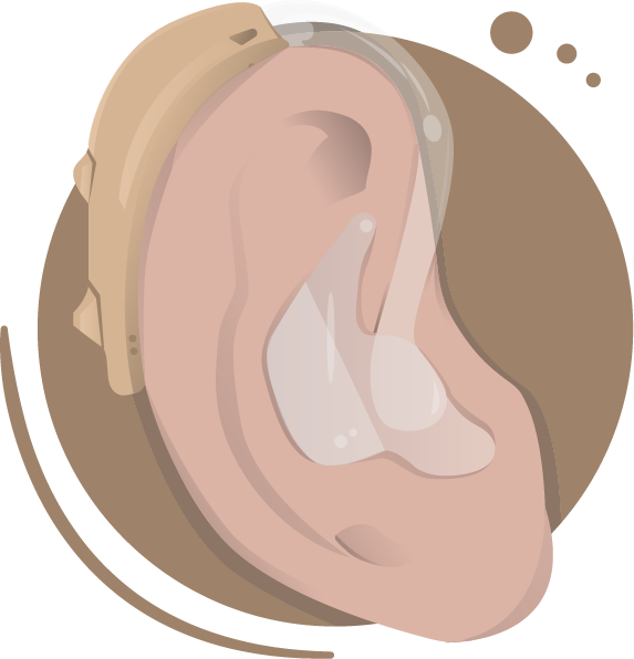 Hearing Aids Today Tend To Be Designed Much More Discreetly - Illustration Clipart (573x596), Png Download