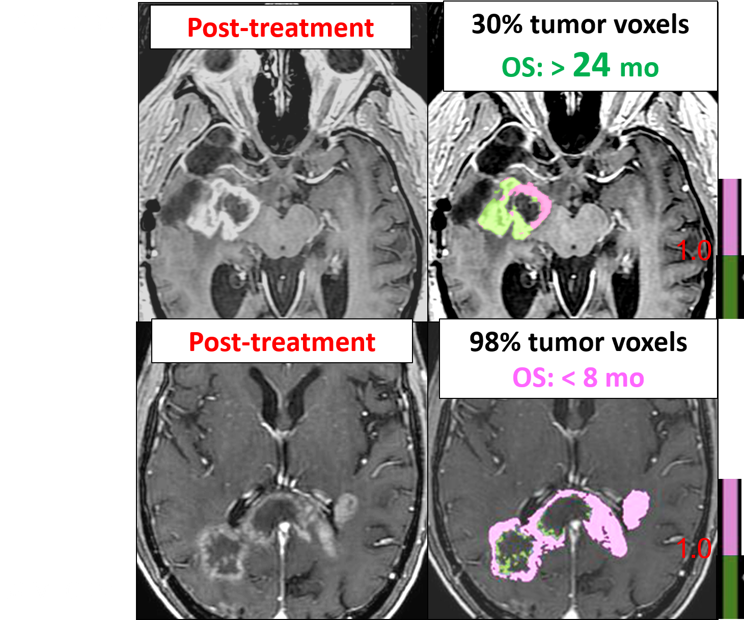 Get In Contact - Computed Tomography Clipart (1502x1227), Png Download