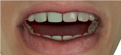 Teeth Test6 960×540 130 Kb - Tongue Clipart (960x540), Png Download