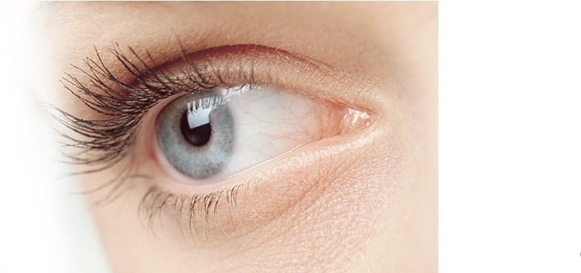 Monovision Lasik Eye Surgery - Under Eye Area Clipart (1101x398), Png Download