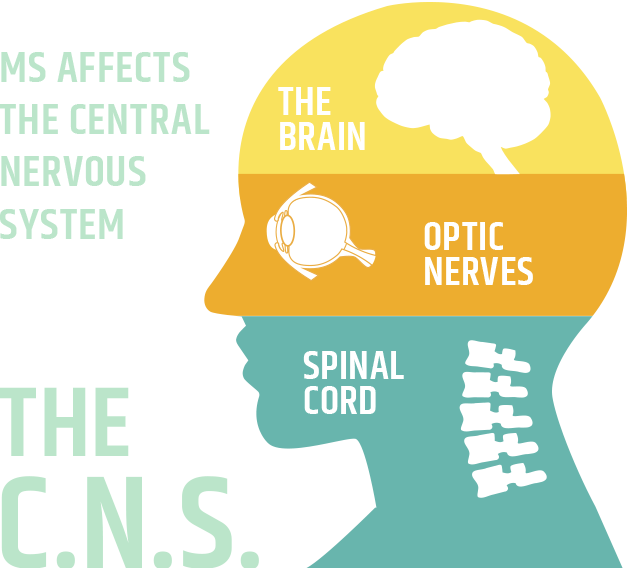 Centeral Nervous System - Multiple Sclerosis Central Nervous System Clipart (629x569), Png Download