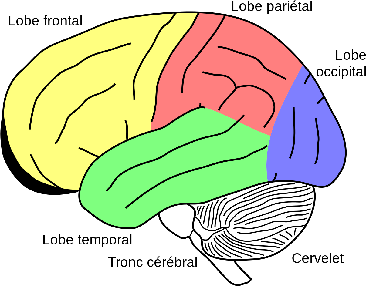Gehirn, Phineas Gage Fr - Cerebellum On Brain Clipart (1280x993), Png Download