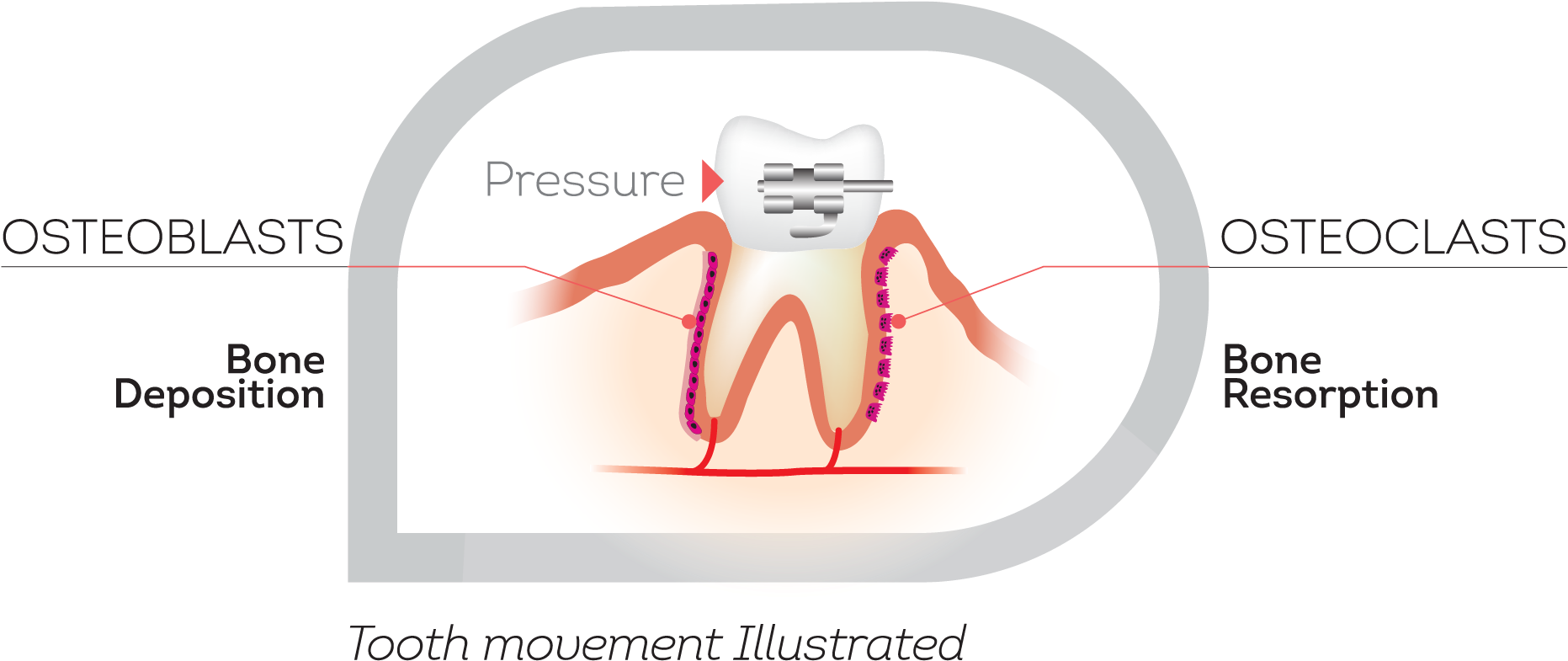 How Teeth Move - Illustration Clipart (2072x965), Png Download